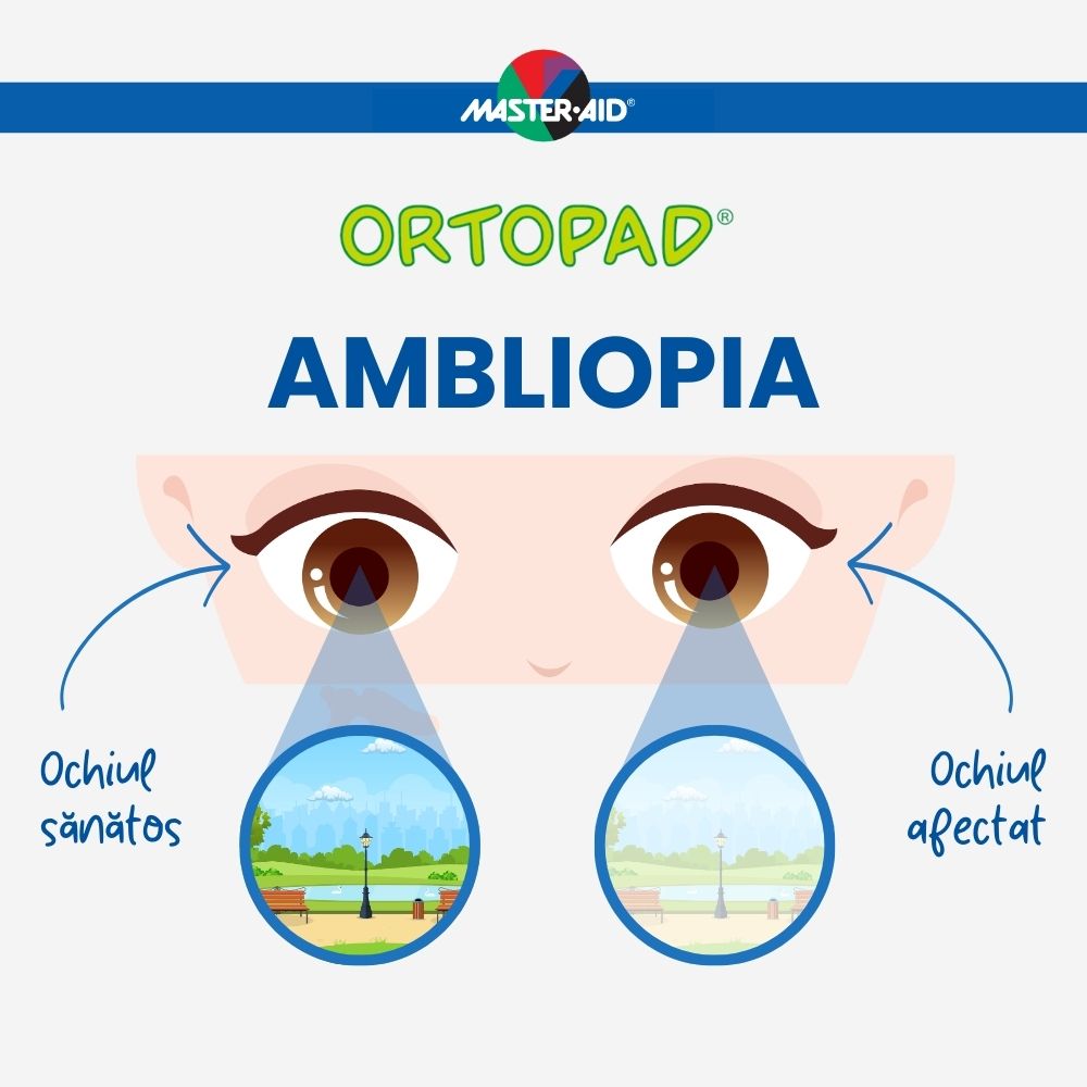 Ortopad Simpaty - Ocluzoare colorate din bambus pentru copii, 50 buc - imagine 16
